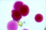 Accolement entre plusieurs protoplastes de chou rouge