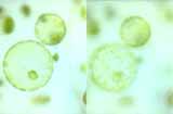 Deux protoplastes de poireau vus avec une mise au point différente