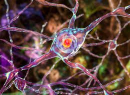 Inclusions neuronales dans la maladie de Huntington - Vue d'artiste