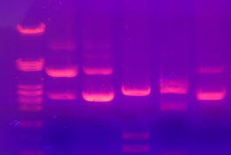 Électrophorèse d'ADN sur gel